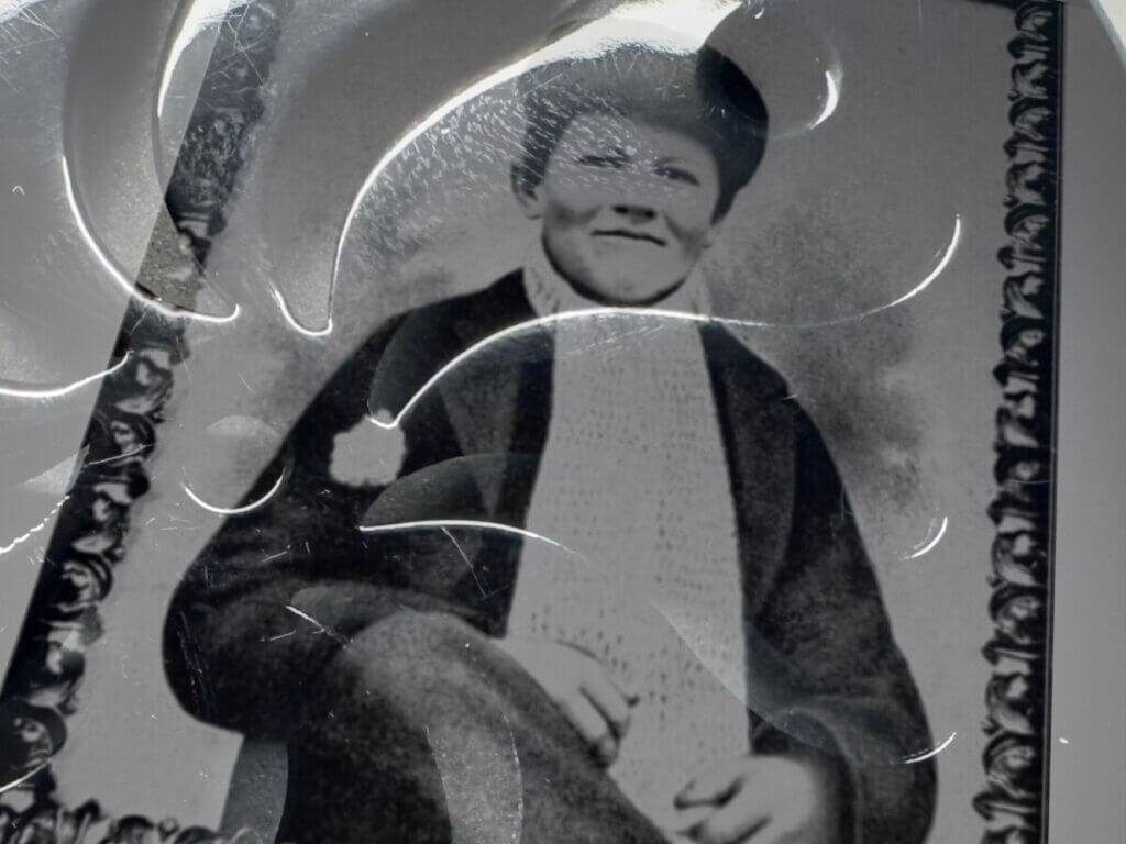 Der etwa 15 Jahre alte Thomas Alva Edison und das Kohlemikrofon von einem Hörgerät